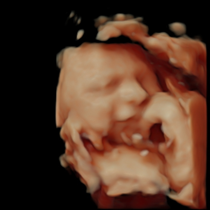 Vanaf hoeveel weken kun je het geslacht zien bij een pretecho